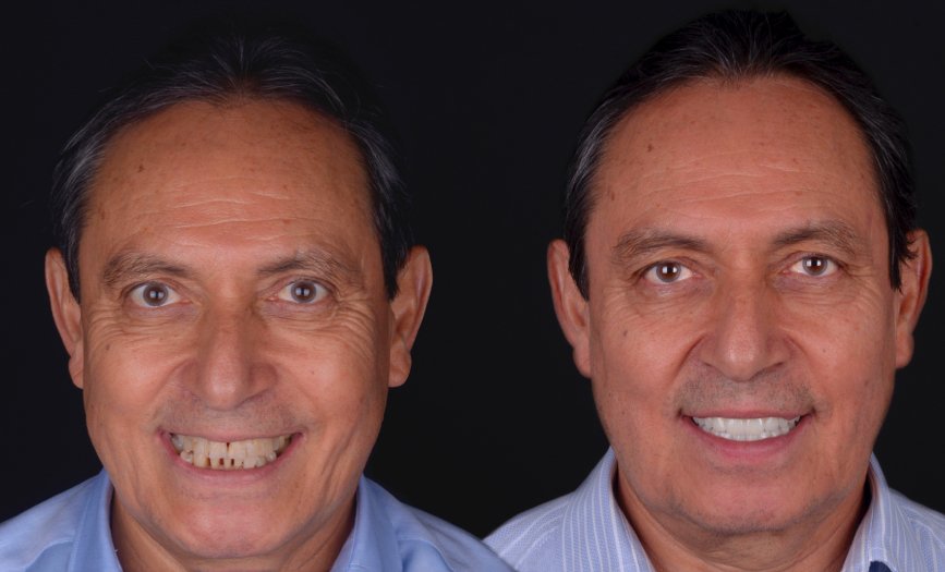 guillermo-7
